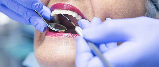 Best Same-Day Emergency Dental Services in Orange, VA